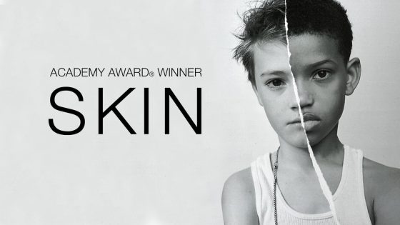 حصريا شاهد فيلم Skin 2018 مترجم